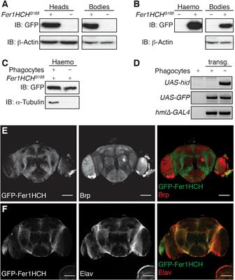 Impact of Autophagy and Aging on Iron Load and Ferritin in Drosophila Brain